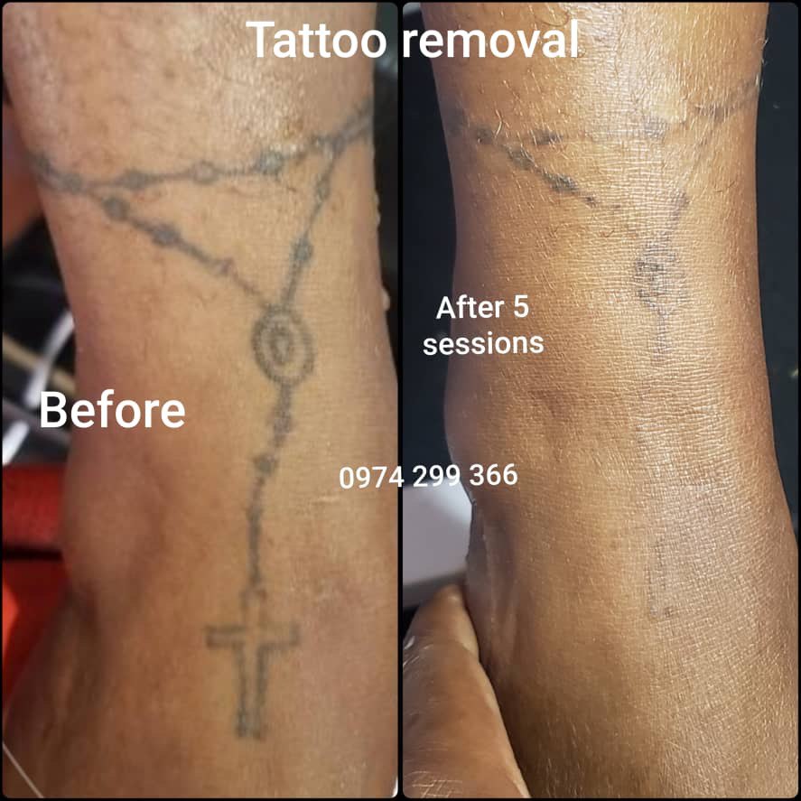 picture of tattoo